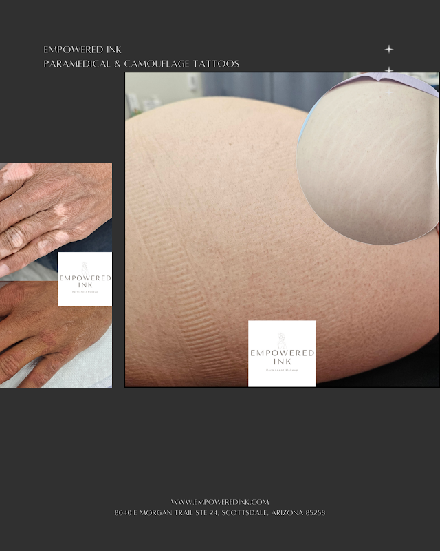 Empowered Ink — laser tattoo removal clinic in Scottsdale